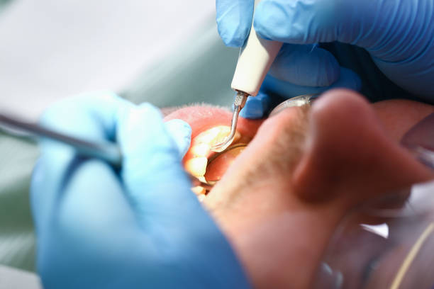 Best Emergency Treatment for Toothache in Monroe, WA