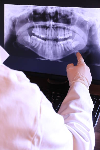 Best Emergency Root Canal Treatment in Monroe, WA